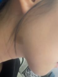 -美瑞莎创美医疗美容