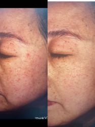 -和颜一美轻医美连锁