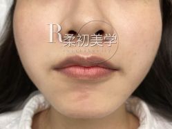-RC半永久纹眉纹发际线