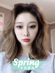 体验后-大麦微针植发全国连锁