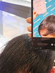 -碧莲盛·不剃发植发