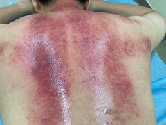 -张钰强中医正骨推拿连锁(唐家人才公寓店)