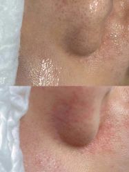 点击看大图 -苑苑vbeauty科技美容SPA