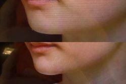 -Yestar 嘉兴艺星医疗美容医院