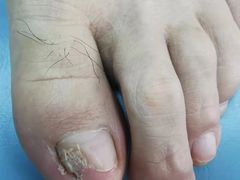 -世龙世家手足健康护理连锁(福田梅林路润裕花园店)