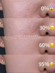 点击看大图 -MLP美丽派·问题肌疗愈中心