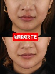 -上海伊莱美医疗美容医院