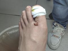 -新甲连锁灰指甲·甲沟炎·鸡眼(黑龙江路店)