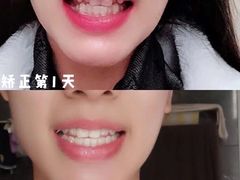 -团圆口腔·种植中心(锦江院区)