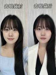 点击看大图 -广州健丽·去眼袋医疗美容机构