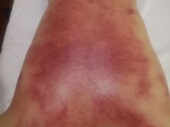 -赵氏盲人按摩(武林门店)