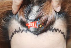 -大麦微针植发全国连锁