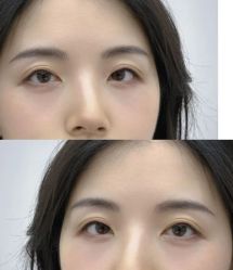 -Doris多里斯半永久纹眉·SMP纹发·发际线