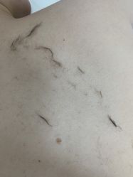 -薇兰专业脱毛连锁机构