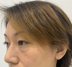 -天津健丽·去眼袋医疗美容机构