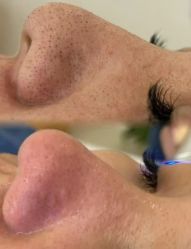 -苗方清颜专业祛痘·皮肤管理