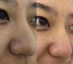 -痘庄科学祛痘国际连锁