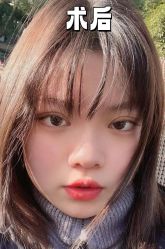 -素美医疗美容·西南眼鼻整形·修复基地