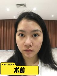 -广州健丽·去眼袋医疗美容机构
