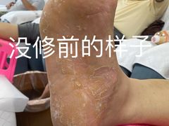 -郑远元专业修脚房(商乐店)