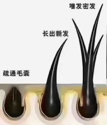 -希梵尔头皮抗衰·科技养发