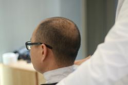 -发饰美男士增发补发假发定制店