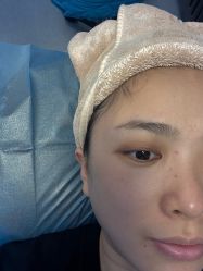 -广州健丽·去眼袋医疗美容机构