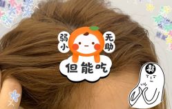 -大麦微针植发全国连锁