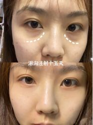 -上海漾颜医疗美容