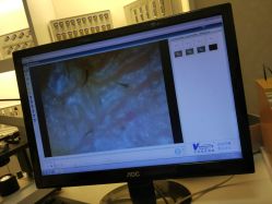 -痘庄科学祛痘国际连锁机构