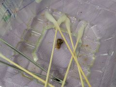 -南方医科大学深圳医院