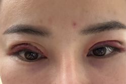 -深圳米兰柏羽医疗美容医院