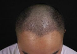 体验后-厦门美莱整形美容医院