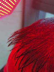 -碧莲盛·不剃发植发