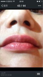 iphone_upload_pic-百秀名媛纹绣美学护肤中心