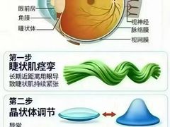 -宝视达眼镜(周口市广场店)
