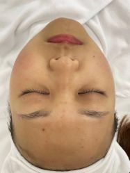 点击看大图 -SKIN79皮肤管理中心