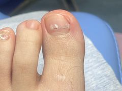 -Andrew指甲专科灰指甲·甲沟炎矫正·3D步态矫形鞋垫定制(上海法华镇路旗舰店)