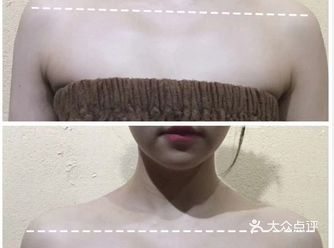 经常玩手机导致现在含胸驼背很严重，在seas小颜做天