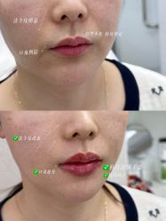 点击看大图 -Yestar艺星整形美容医院
