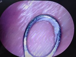 -凡碧诗毛孔清洁收细