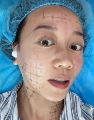 -深圳米兰柏羽医疗美容医院