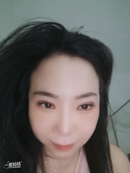 体验后-海峡医疗美容医院