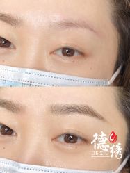 -德绣·机器野生眉发际线·美瞳线半永久