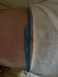 -肥三针腧穴瘦身馆