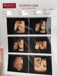-杭州贝瑞斯美华妇儿医院·早孕·产检·儿科