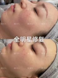 -LUNA皮相美·骨相美高级美感