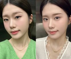 -素美医疗美容·西南眼鼻整形·修复基地