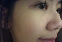 -白博士祛痘·皮肤管理中心