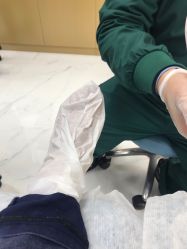 -派恩宜灰指甲鸡眼嵌甲手足癣